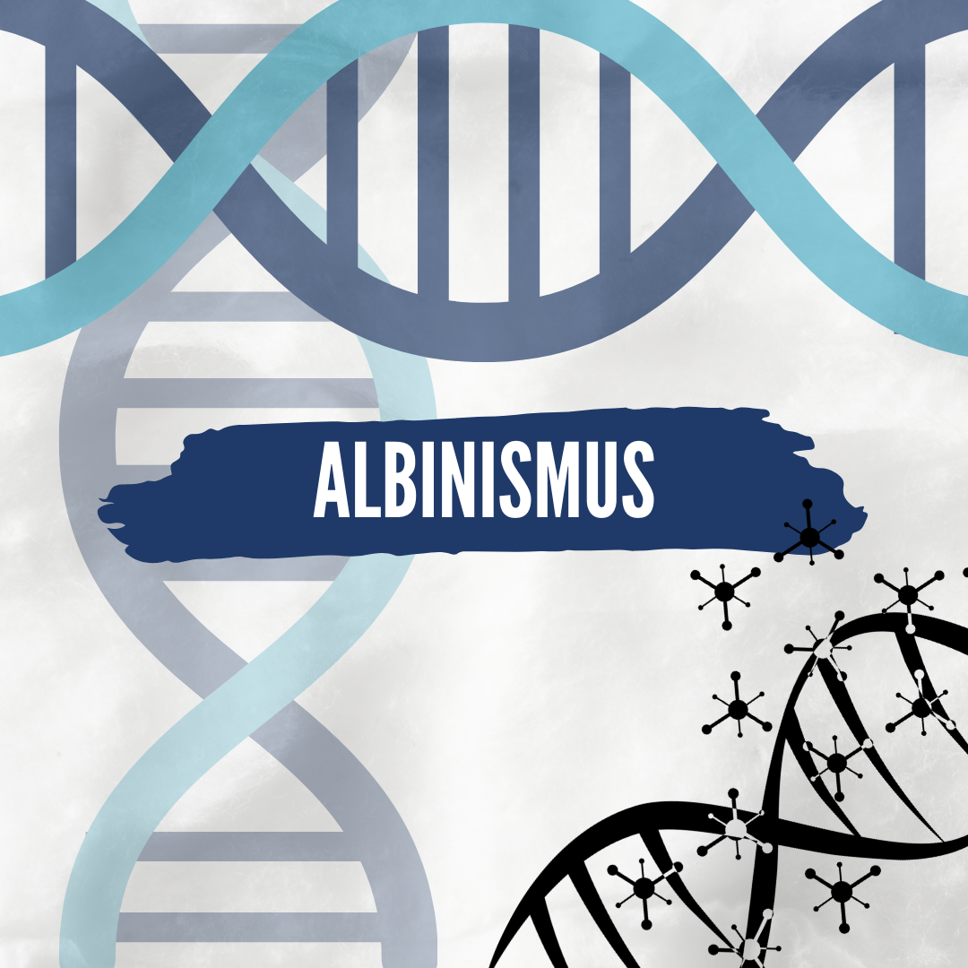 albinismus