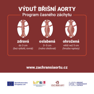 infogram vydut brisni aorty